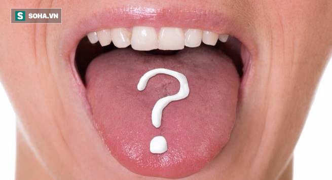 Quên chải lưỡi khi đánh răng gây ra 4 bệnh nguy hiểm: Đây là cách làm sạch lưỡi hàng ngày - Ảnh 1.