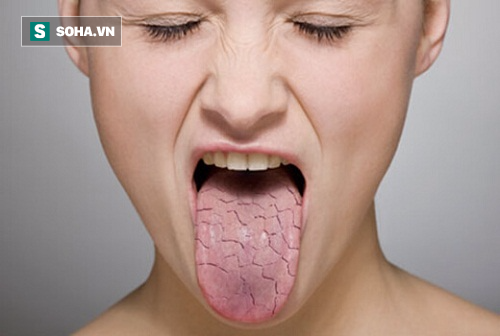 Dù rất chịu khó đánh răng, nhưng 6 nguyên nhân sau khiến miệng vẫn bị hôi - Ảnh 1.