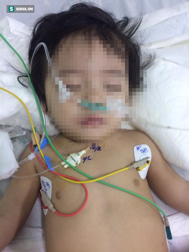 Cháu bé 13 tháng tuổi chấn thương sọ não nghi bị bảo mẫu bạo hành - Ảnh 1.