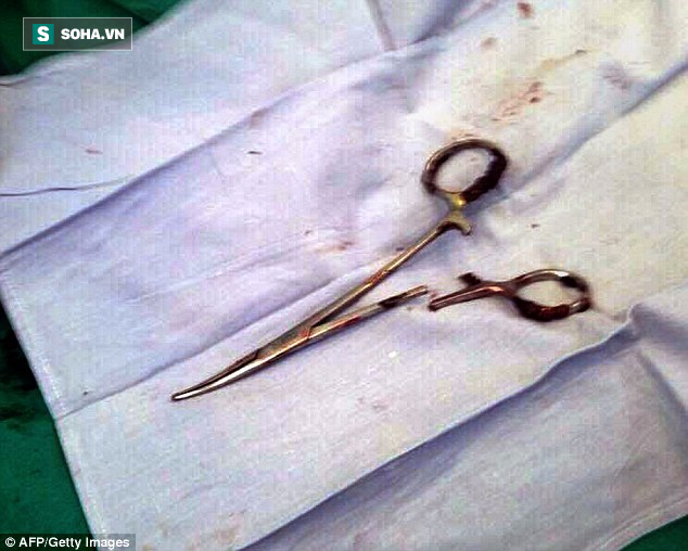 Bác sĩ Việt Nam bỏ quên kéo trong bụng bệnh nhân 18 năm khiến báo chí nước ngoài xôn xao - Ảnh 2.