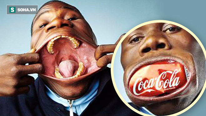Dị nhân: Chàng trai được chứng nhận kỷ lục Guinness miệng rộng nhất thế giới - Ảnh 1.
