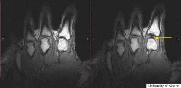 Nếu có thói quen bẻ ngón tay kêu khục khục, đây sẽ là những gì đang diễn ra trong cơ thể bạn - Ảnh 2.