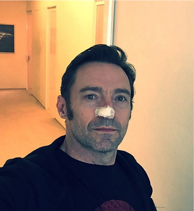 Người sói Hugh Jackman và thông điệp gửi đến người hâm mộ trên Instagram sau khi bị ung thư da - Ảnh 1.