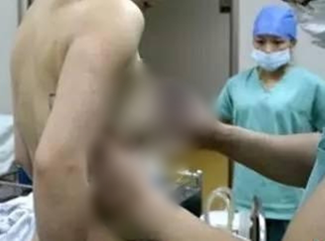 Sau 10 năm thẩm mỹ, người phụ nữ cay đắng gỡ miếng độn ngực đang dần trôi về sau lưng - Ảnh 2.