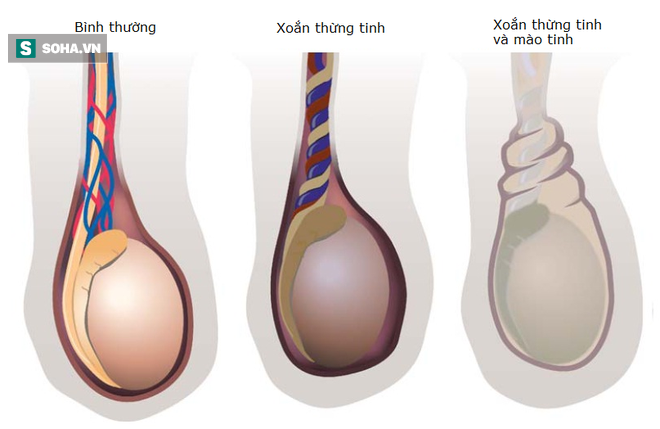 Bác sĩ cảnh báo: Khi quý ông có triệu chứng này, cần phải vào viện khám càng sớm càng tốt - Ảnh 1.