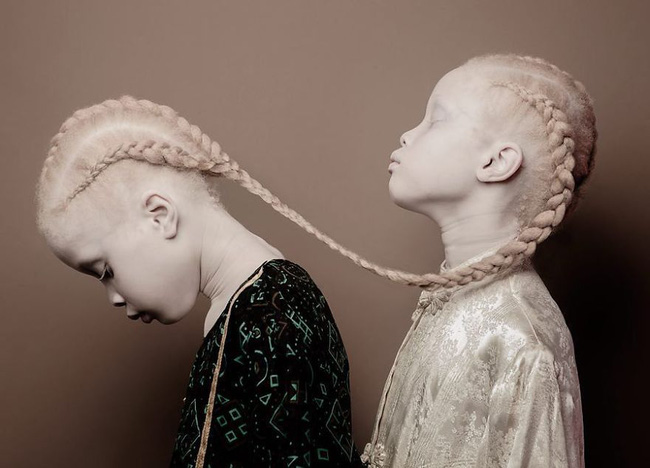 Vẻ đẹp lạ của cặp chị em song sinh bị bạch tạng gây xôn xao ngành công nghiệp thời trang Brazil - Ảnh 1.