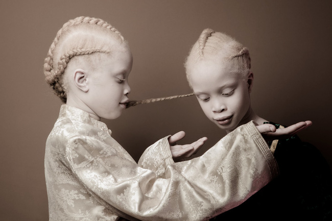Vẻ đẹp lạ của cặp chị em song sinh bị bạch tạng gây xôn xao ngành công nghiệp thời trang Brazil - Ảnh 2.