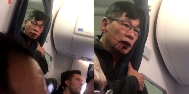 CEO United Airlines đổ thêm dầu vào lửa: Mắng nạn nhân hung hăng, khen nhân viên hết lời - Ảnh 1.