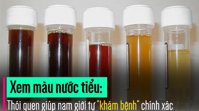 5 dấu hiệu cảnh báo thận của bạn đang kêu cứu, hãy lắng nghe cơ thể để xử lý kịp thời - Ảnh 1.