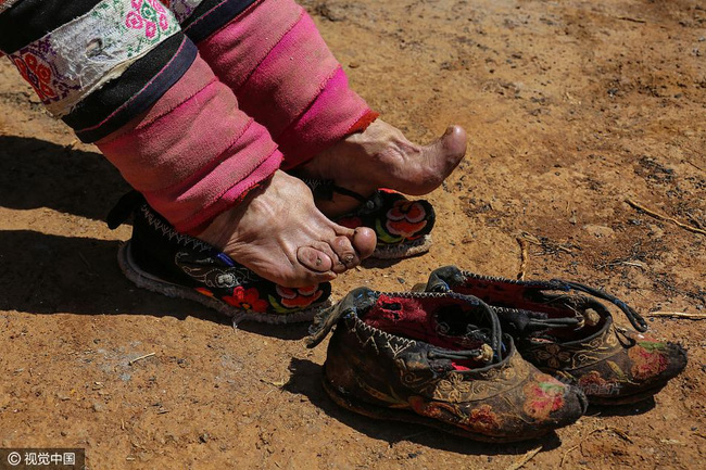 Mục sở thị những đôi chân gót sen cuối cùng của phụ nữ Trung Quốc thời hiện đại - Ảnh 1.