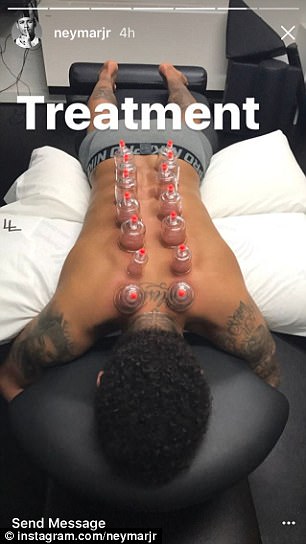 Chấn thương nặng, Neymar cậy nhờ phương pháp chữa trị kiểu Việt Nam - Ảnh 1.