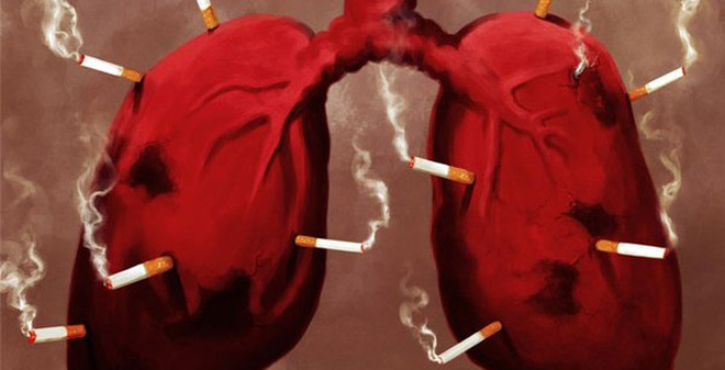 Ung thư phổi có tỷ lệ tử vong rất cao: 4 nhóm người cần đặc biệt chú ý đến việc khám phổi - Ảnh 5.