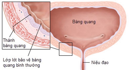 Nhậu đến vỡ bàng quang, không nhập viện lo đi ngủ - Ảnh 2.