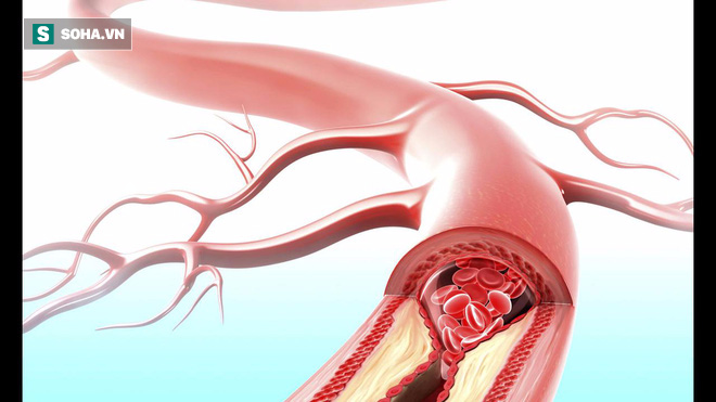 Công thức chữa bệnh cổ đại của người Đức thông mạch máu, giảm cholesterol trong 3 tuần - Ảnh 1.