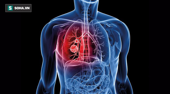 Gan, phổi, dạ dày nhiễm độc: Danh y chỉ các dấu hiệu và cách thải độc ai cũng nên bỏ túi - Ảnh 5.