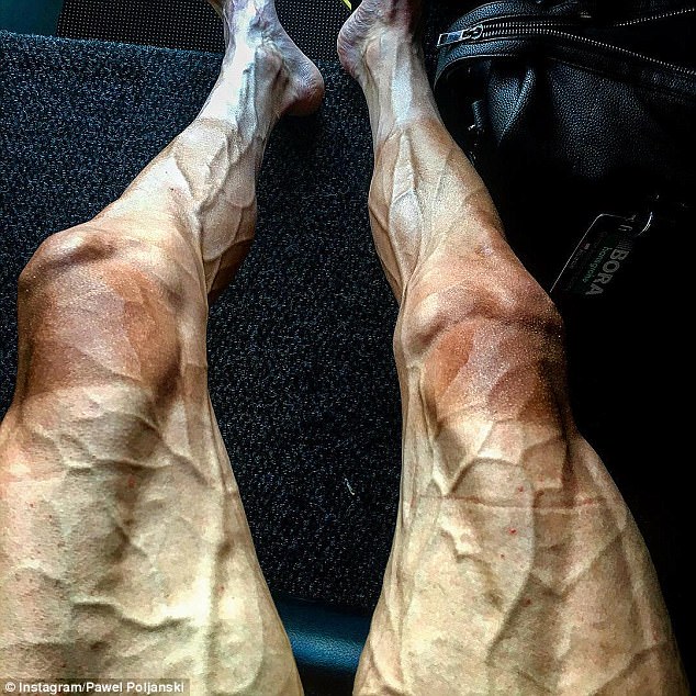 Tại sao đôi chân của các vận động viên đua xe đạp lại biến dạng khủng khiếp đến nhường này? - Ảnh 1.