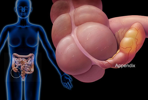 Lý giải những nguyên nhân gây đau bụng dưới ở phụ nữ - Ảnh 2.