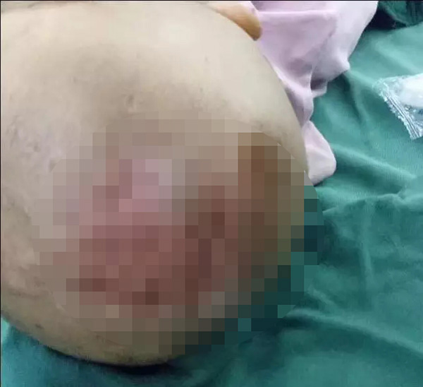 Bé gái 3 tuổi bị bỏng da đầu, kim đâm chi chít ở bụng từ những lần tra tấn dã man của mẹ kế - Ảnh 1.