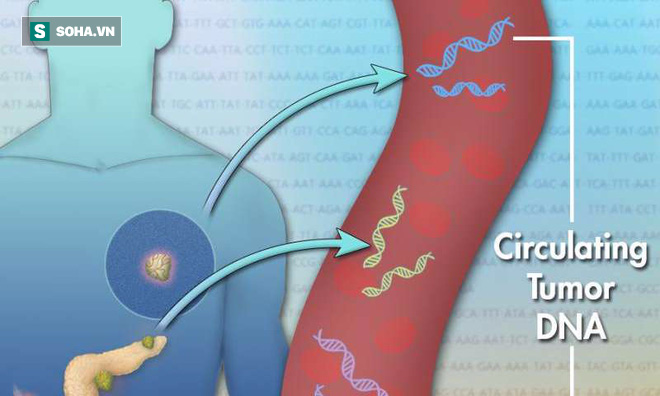 Các nhà khoa học tìm ra phương pháp mới giúp chuẩn đoán ung thư trước khi có triệu chứng - Ảnh 1.