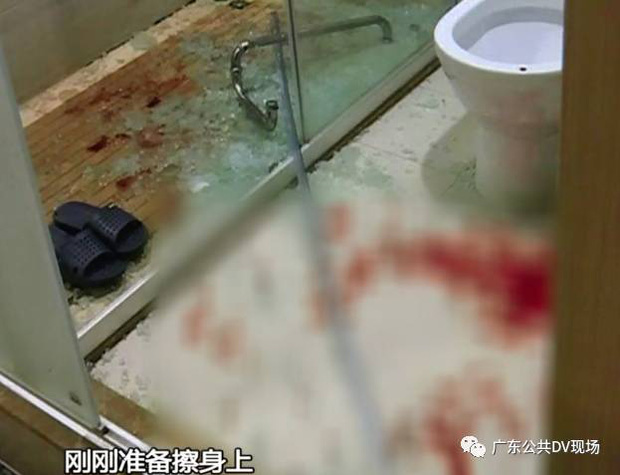 Cửa kính phòng tắm trong khách sạn đột ngột vỡ tung khiến người đàn ông đang tắm bị thương nặng - Ảnh 1.