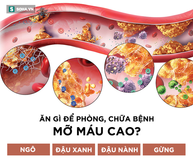 Không phải thuốc hay cao lương mĩ vị, 4 món dân dã này sẽ đánh bật bệnh mỡ máu cao - Ảnh 1.