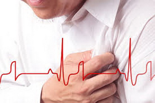 Sự khác biệt giữa đột quỵ và cơn đau tim - Ảnh 1.
