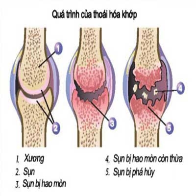 Cá - thần dược cho viêm khớp dạng thấp - Ảnh 2.