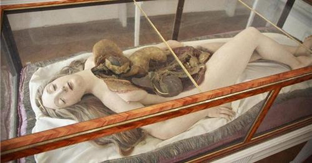 Thần vệ nữ bị mổ bụng - những người đẹp giải phẫu 200 tuổi khiến y học cúi đầu - Ảnh 1.