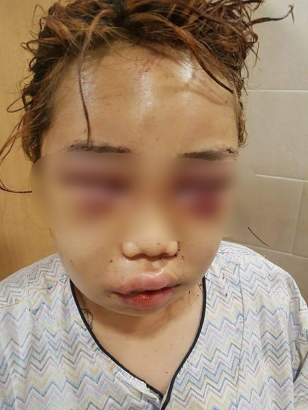 Hàn Quốc: Bị đàn chị quây đánh hội đồng, nữ sinh 14 tuổi toàn thân đầy máu, mặt mũi biến dạng phải quỳ gối hối lỗi - Ảnh 2. Hàn Quốc: Bị đàn chị quây đánh hội đồng, nữ sinh 14 tuổi toàn thân đầy máu, mặt mũi biến dạng phải quỳ gối hối lỗi - Ảnh 2.