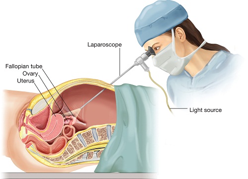 23 câu hỏi thường gặp về HPV và tiêm phòng HPV - Ảnh 2.