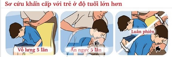 Tử vong do sặc cháo: Nếu biết cách cấp cứu kịp thời có thể cứu mạng trẻ - Ảnh 1.