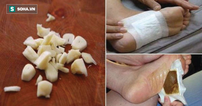 Học phương pháp thải sạch chất độc khỏi cơ thể của người Nhật chỉ sau một đêm - Ảnh 2. Học phương pháp thải sạch chất độc khỏi cơ thể của người Nhật chỉ sau một đêm - Ảnh 2.