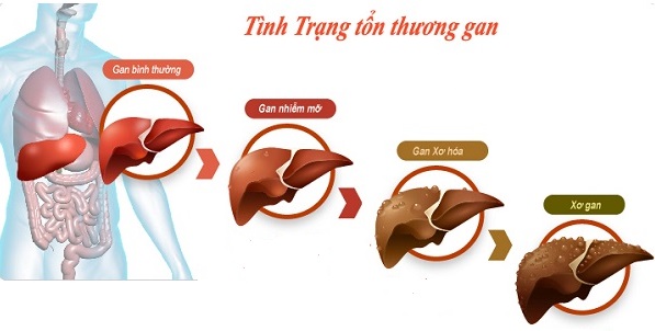 Nam giới muốn khỏe, trước hết đừng để gan, phổi, dạ dày có bệnh: Đây là 3 điều nên làm! - Ảnh 3.