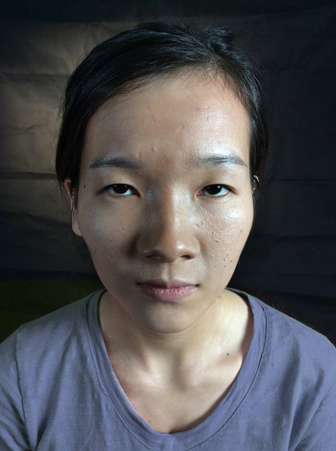 Màn lột xác bất ngờ của nữ sinh ĐH Y khoa Vinh từng bị nhà người yêu từ chối vì có đôi mắt lươn - Ảnh 1.