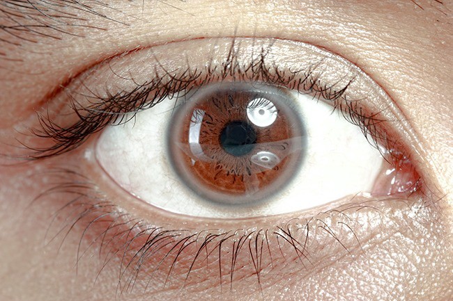 Có thể bị mù vĩnh viễn nếu mắt có dấu hiệu này mà mặc kệ không đi khám - Ảnh 1.