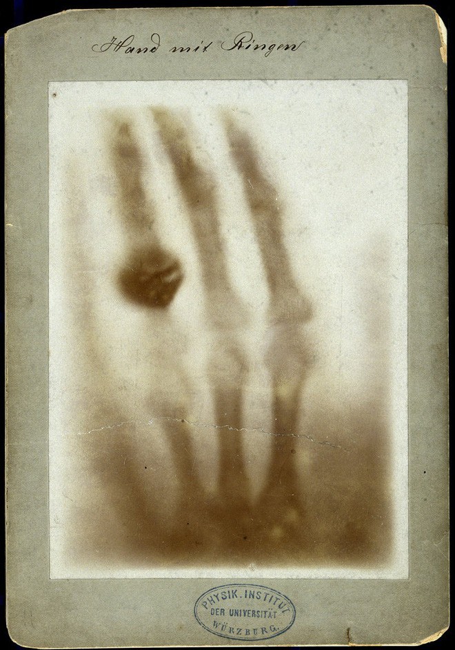 Tấm ảnh X-quang đầu tiên của nhân loại này đã làm vợ của nhà phát minh ra nó vô cùng hoảng hốt - Ảnh 1.