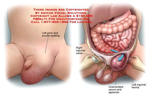 Đổi tư thế “chuyện ấy”, vợ phát hiện chồng mắc bệnh nam khoa - Ảnh 1.