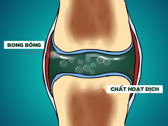 Chuyên gia tự bẻ khớp tay suốt 60 năm liền chỉ để chứng minh một điều nho nhỏ - Ảnh 1.