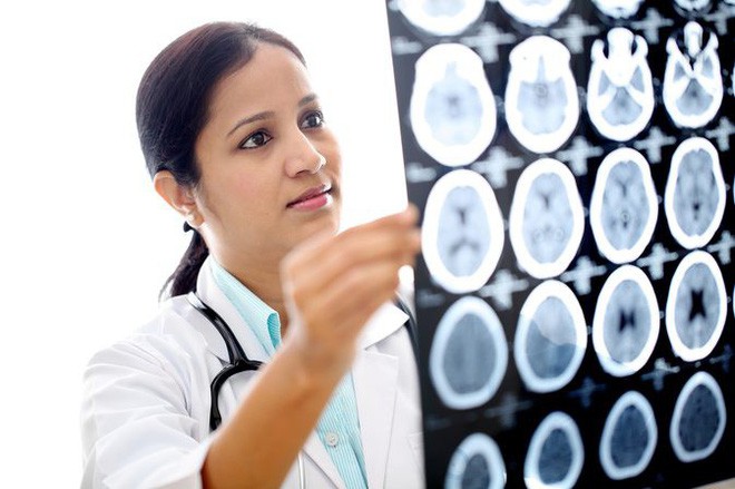 6 dấu hiệu cảnh báo có thể bạn đang có một khối u trong não - Ảnh 1.