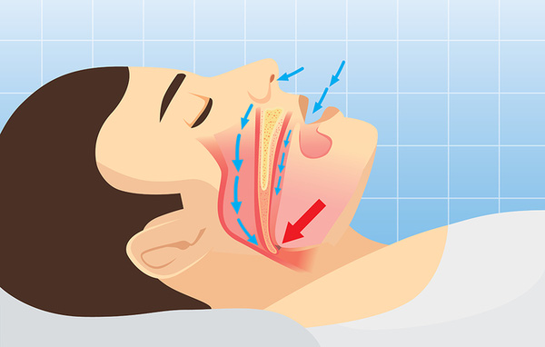 6 bệnh gần như không có triệu chứng rõ ràng ban đầu, khi phát hiện ra thì đã nặng - Ảnh 3.