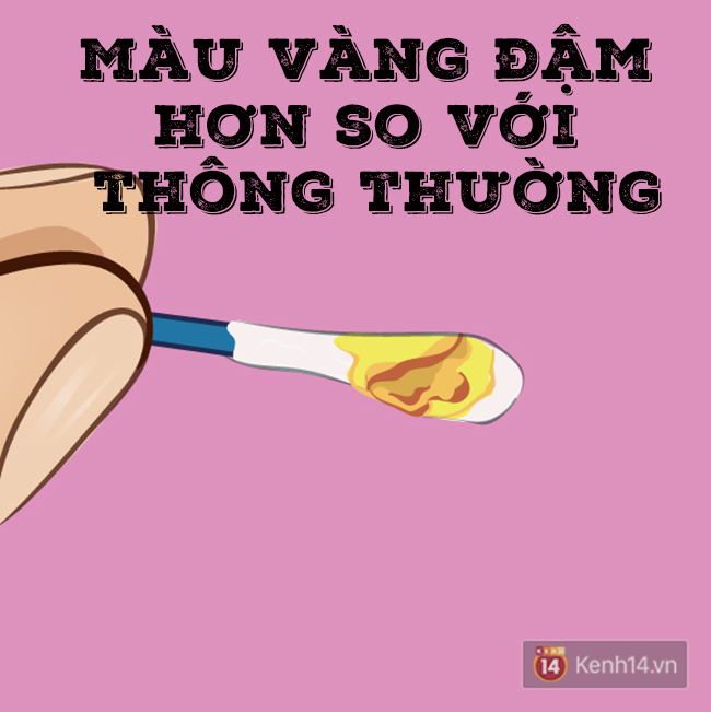 Ngoáy tai xong, nhớ nhìn ráy tai để biết được tình trạng sức khoẻ của mình đang như thế nào - Ảnh 3.