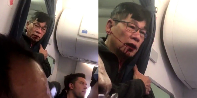 Những bê bối ẩn giấu phía sau vụ hãng hàng không lớn thứ 2 thế giới đối xử thô bạo với hành khách - Ảnh 3.