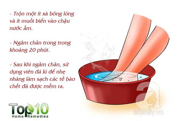 7 mẹo hàng đầu giúp bạn không bị nhiễm trùng và nứt gót chân trong mùa đông này - Ảnh 2.