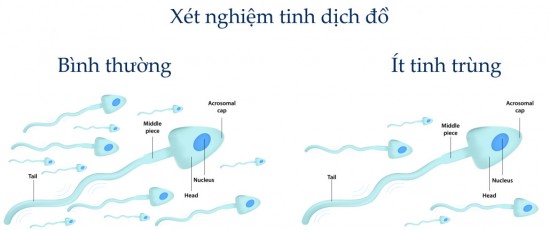 Mãn dục nam - hiểu để ứng phó phù hợp - Ảnh 2.