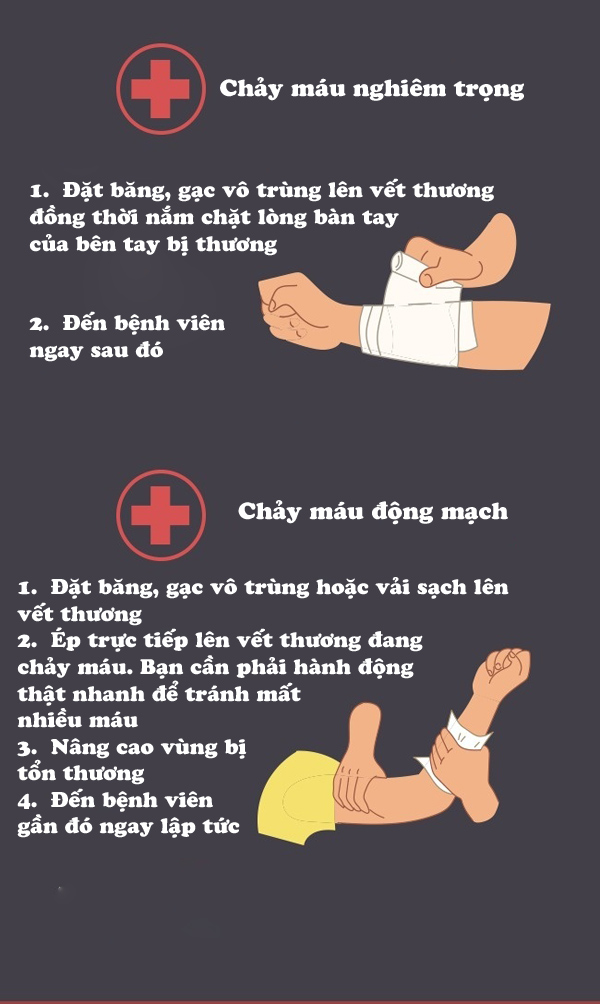 Cách sơ cứu một số trường hợp khẩn cấp mọi người phải biết để không mất mạng - Ảnh 4.