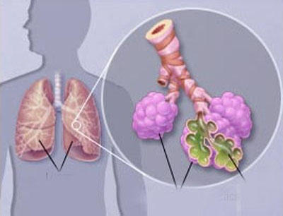 PGS.TS Vũ Văn Giáp: Giao mùa, bệnh viêm đường hô hấp gia tăng - Ảnh 1.
