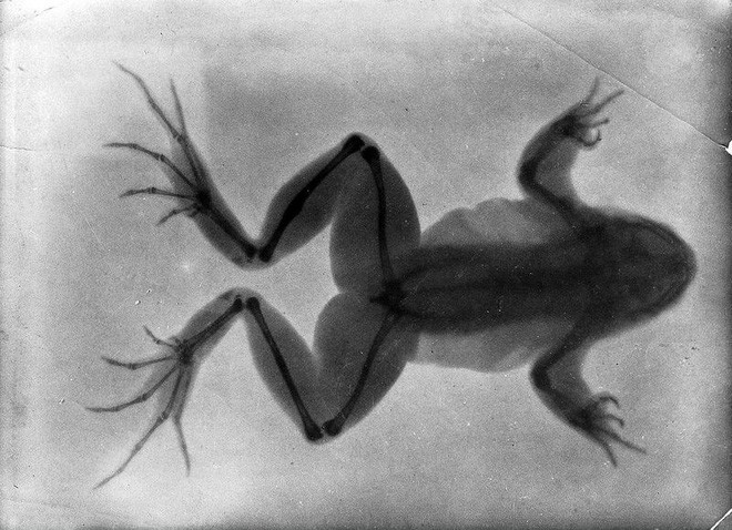 Tấm ảnh X-quang đầu tiên của nhân loại này đã làm vợ của nhà phát minh ra nó vô cùng hoảng hốt - Ảnh 4.
