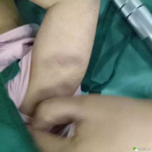 Bé gái 3 tuổi bị bỏng da đầu, kim đâm chi chít ở bụng từ những lần tra tấn dã man của mẹ kế - Ảnh 5.