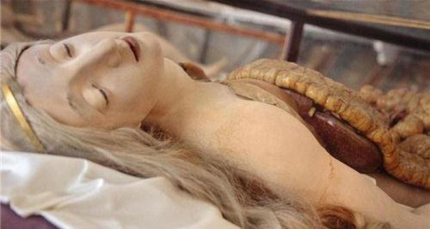 Thần vệ nữ bị mổ bụng - những người đẹp giải phẫu 200 tuổi khiến y học cúi đầu - Ảnh 4.