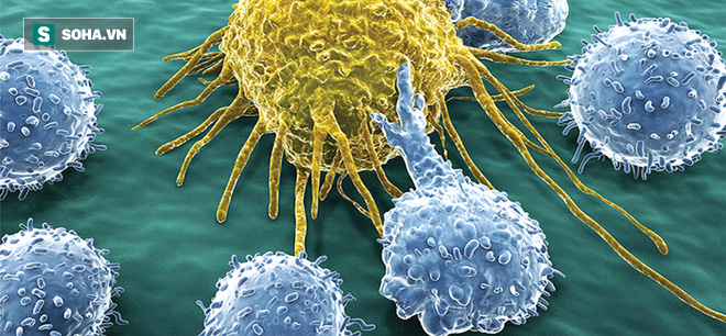 Phát hiện sớm ung thư vú - bí quyết để sống sót: Những bước phòng ngừa ai cũng cần biết - Ảnh 5.
